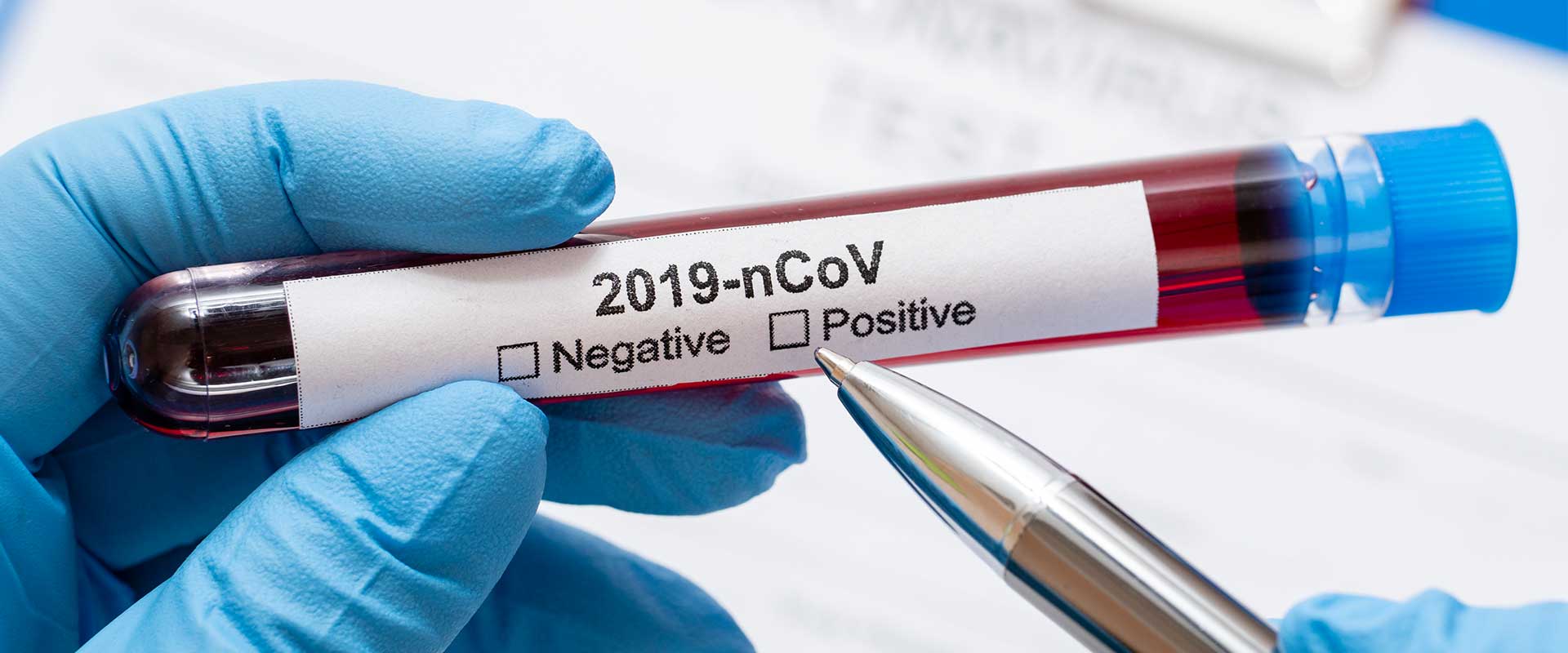 Sorularla Yeni Koronavirüs (COVID-19)